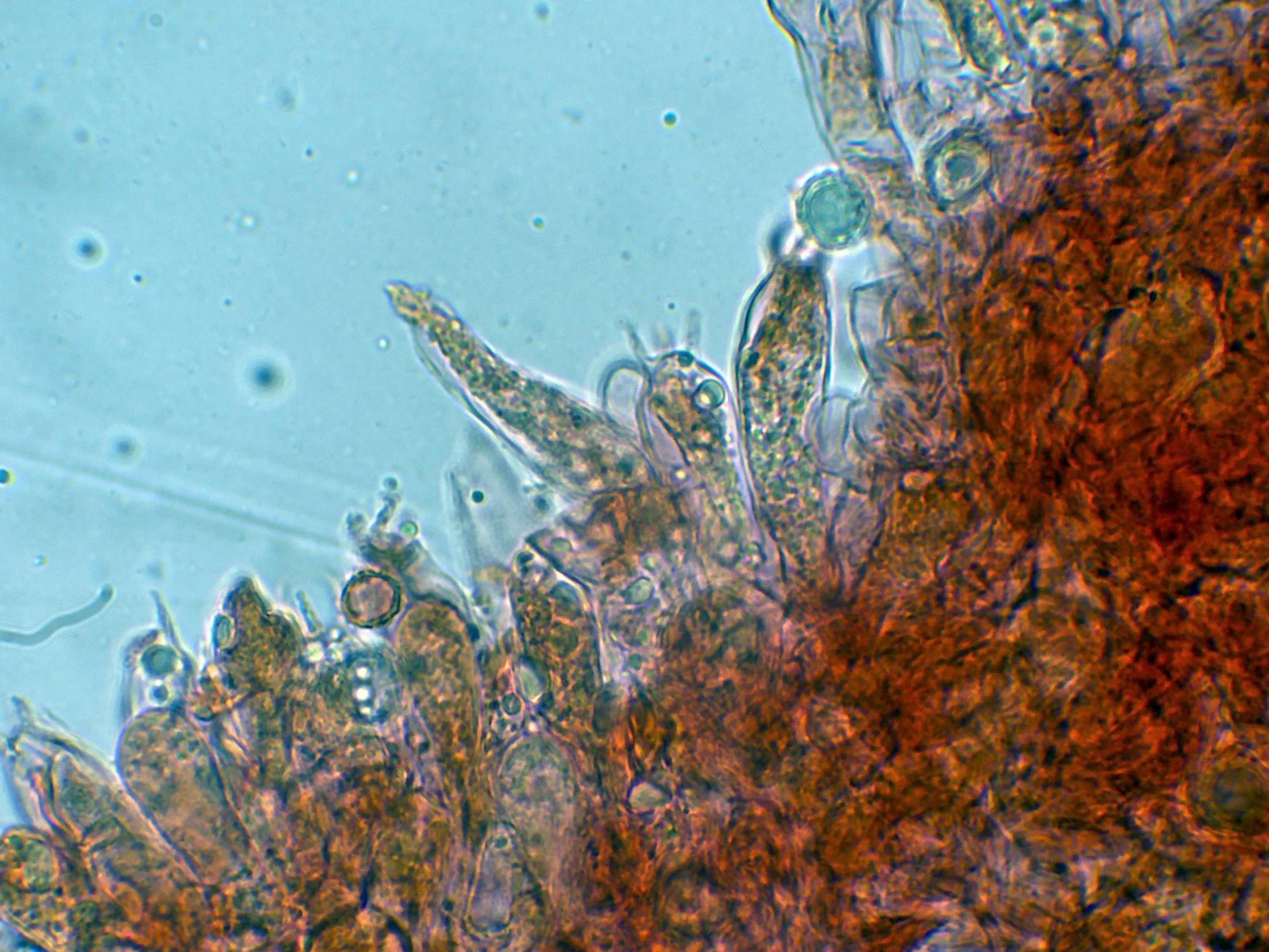 Microscopía de Russula curtipes - 10 - Cistidio-001